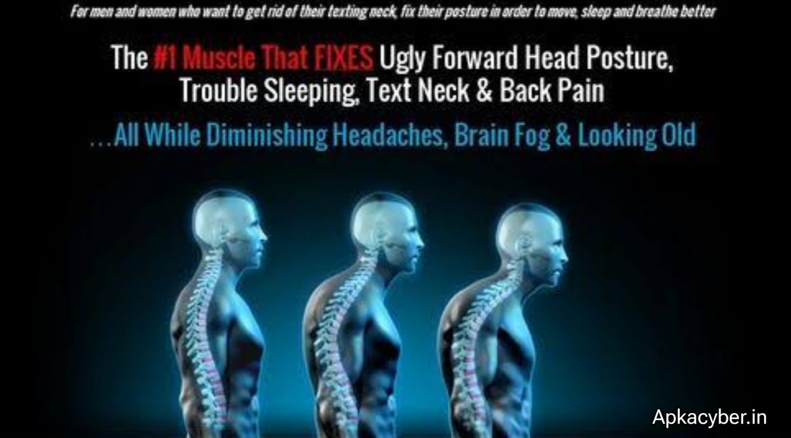 Review Forward Head Posture FIX