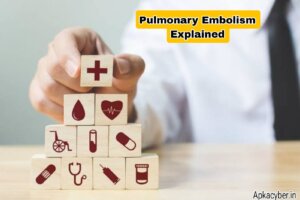 Pulmonary Embolism 